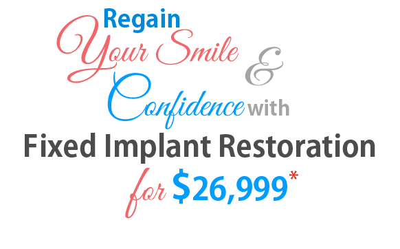 Fixed Implants Dentures Offer
