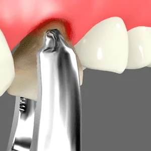 Oral Surgery Rancho Mirage