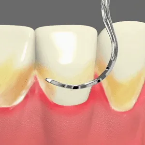 Periodontal Care Rancho Mirage