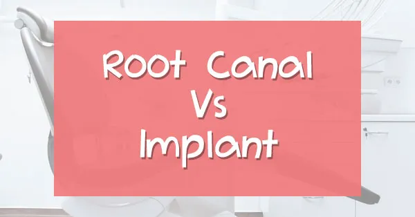 Root Canal Treatment Vs Dental Implants | Palm Desert Root Canal Treatment Vs Dental Implants | Palm Desert