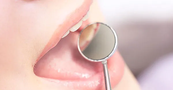 The Necessity for Routine Dental Check-Ups | Rancho Mirage The Necessity for Routine Dental Check-Ups | Rancho Mirage