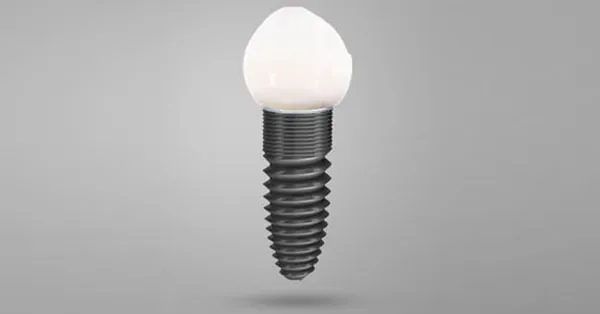 Top Dental Implant Specialist for Rancho Mirage and Surrounding Areas Top Dental Implant Specialist for Rancho Mirage and Surrounding Areas